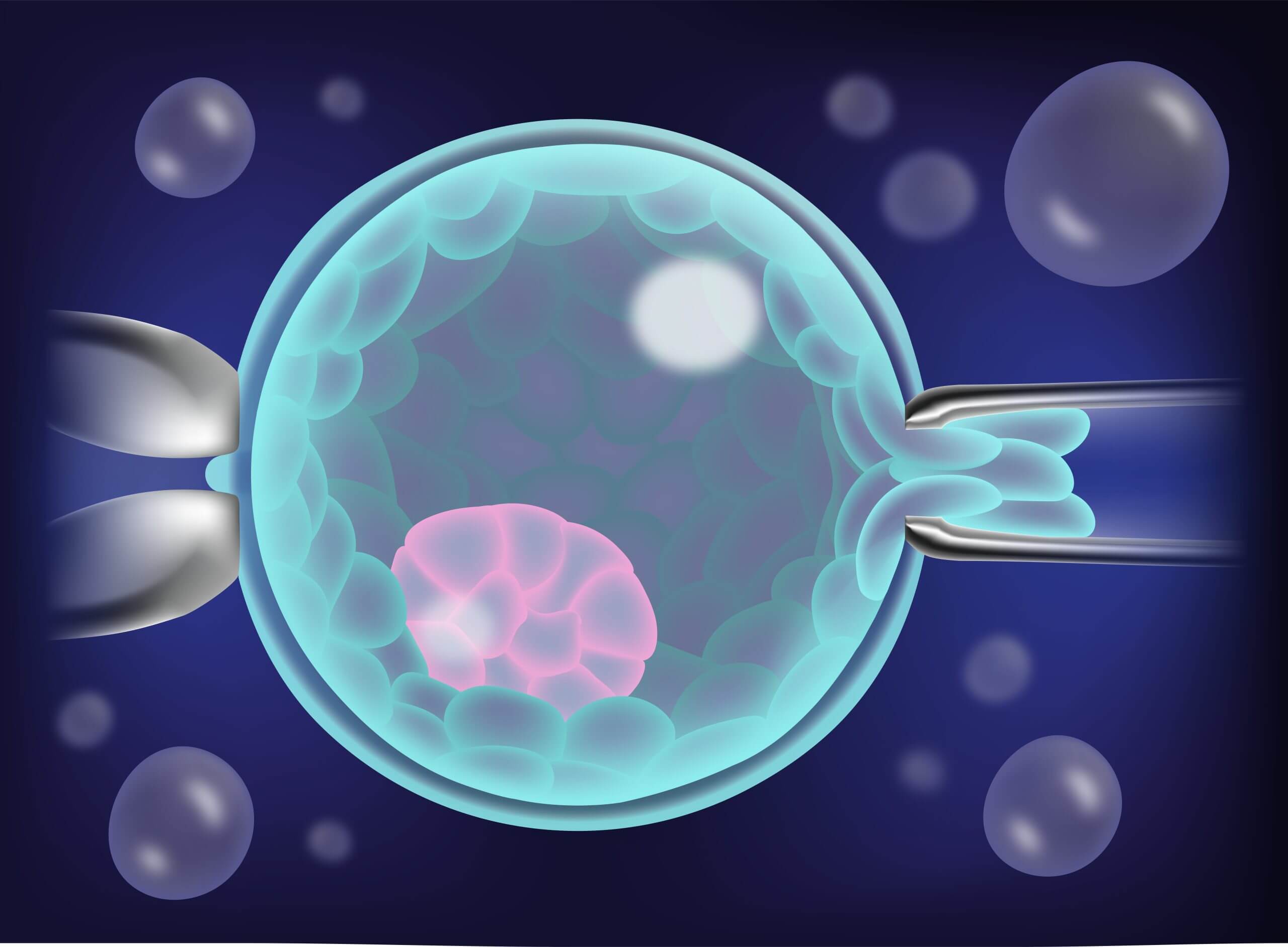 PGD Preimplanstation Genetic Screening